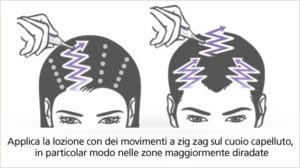 come applicare neogenic